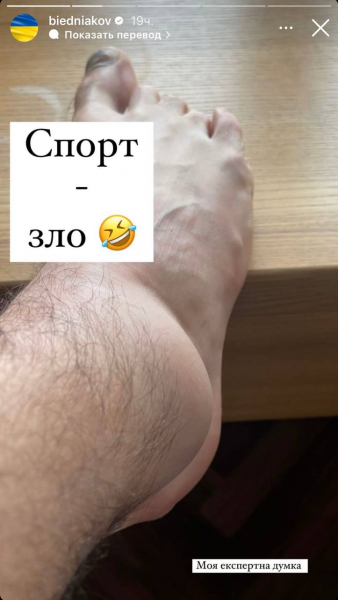 Андрій Бєдняков травмував ногу: Спорт – зло