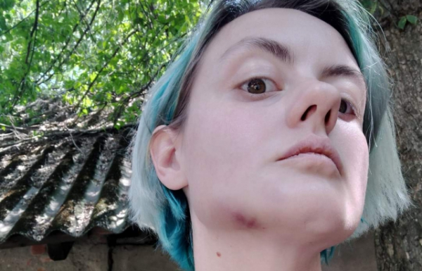 Реакція ТЦК та подробиці: В Ужгороді нетверезий працівник ТЦК побив жінку (ФОТО)