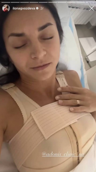 Хореограф Ілона Гвоздьова зробила операцію зі збільшення грудей