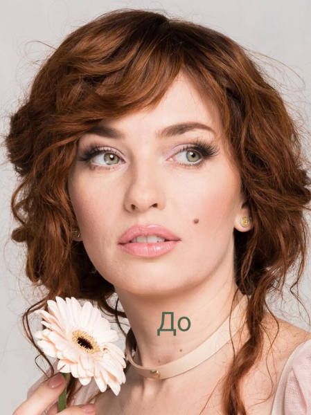 Булітко показала обличчя через пів року після пластичної операції